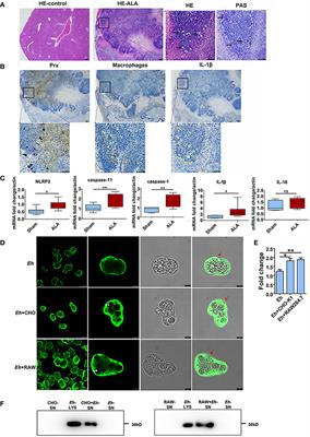 A Novel TLR4-Binding Domain of Peroxiredoxin From Entamoeba histolytica Triggers NLRP3 Inflammasome Activation in Macrophages